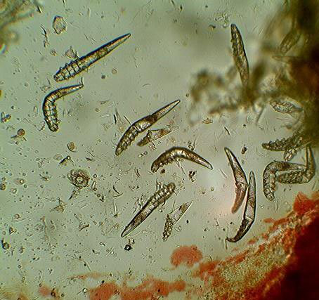 Demodex при микроскопии соскоба с кожи